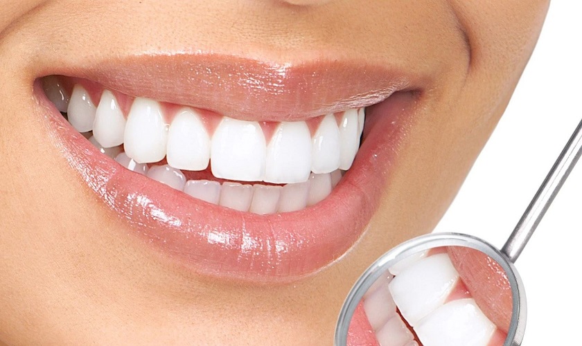 Răng sứ đổi màu: Hiểu nguyên nhân và cách phòng tránh