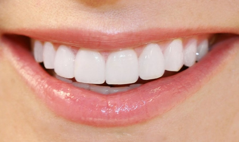 Những trường hợp nào nên và không nên bọc răng sứ?